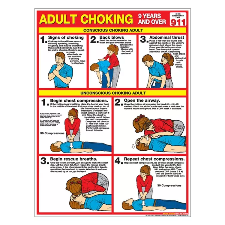 Choking Chart: Adult (Paper)