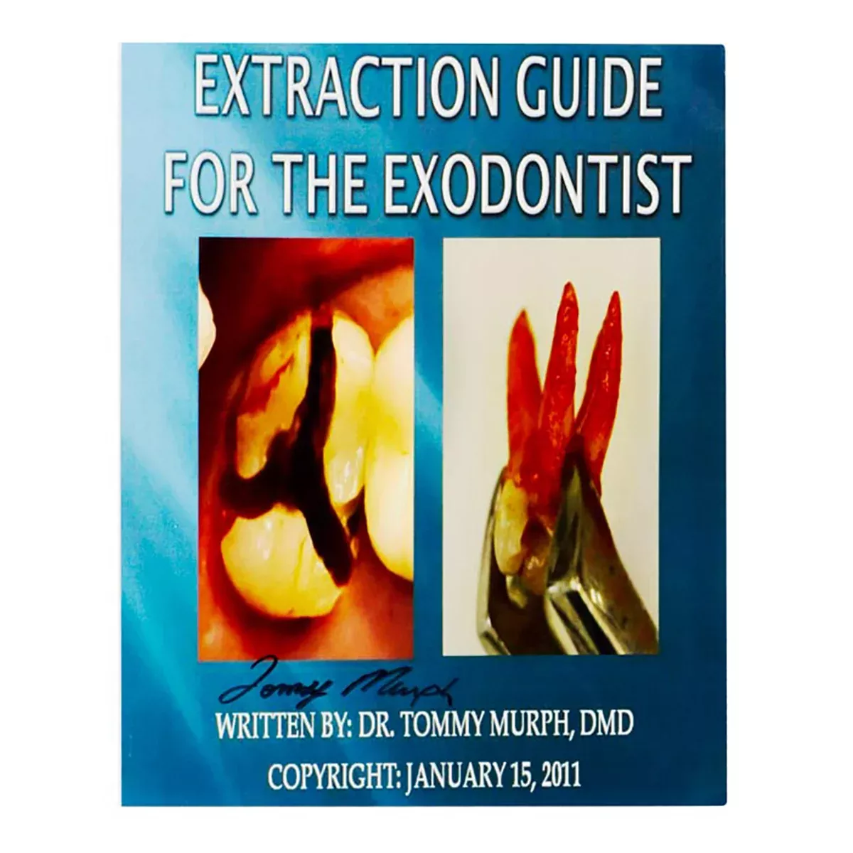 Extraction Guide for the Exodontist