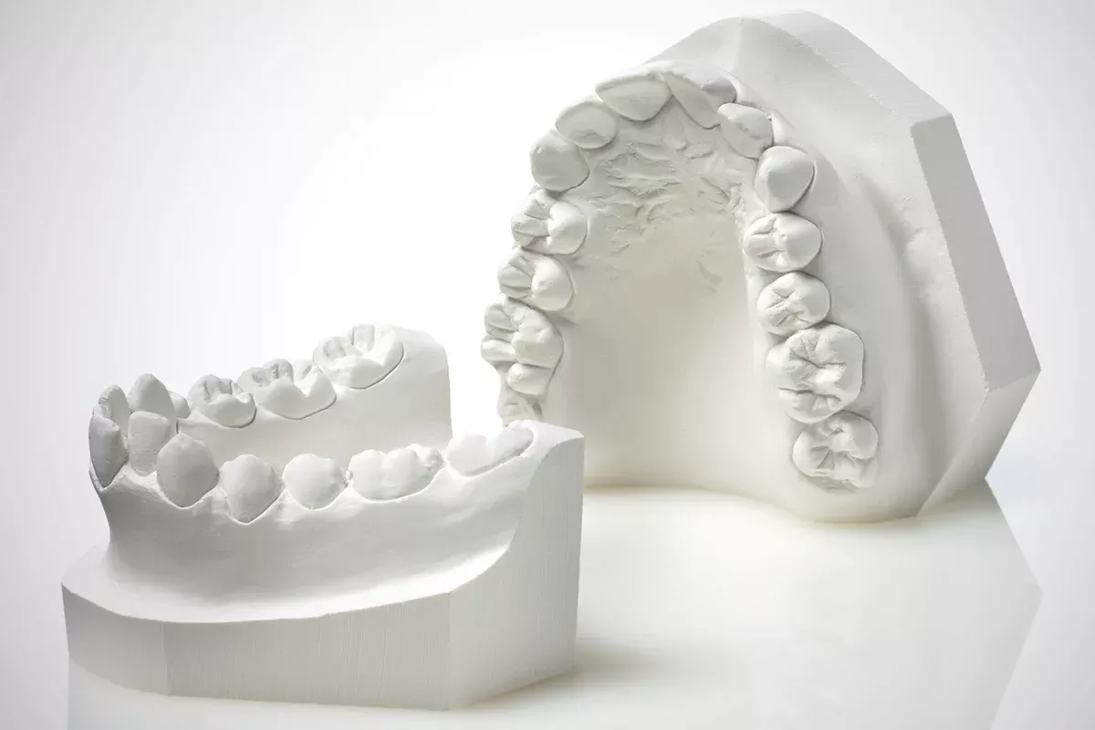 Modern Materials O-67 Orthodontic Stone Type III - Snow White