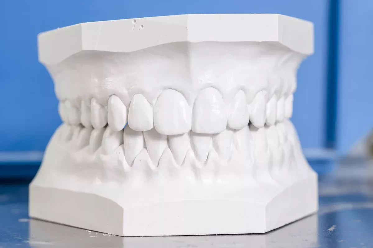 Modern Materials Orthodontic Plaster Type II - Super White